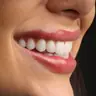 Paciente da CIOT com sorriso transformado em Palmas-TO
