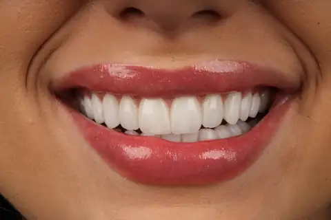 Sorriso transformado na CIOT