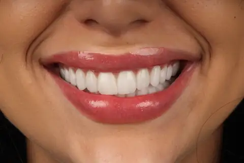 Sorriso transformado na CIOT