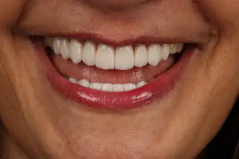 Sorriso transformado na CIOT