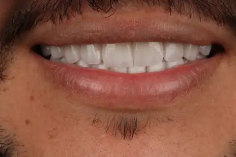 Sorriso transformado na CIOT